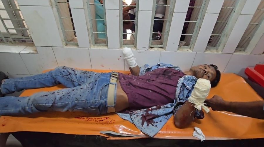 নয় মামলার আসামির দুই হাতের কব্জি বিচ্ছিন্ন করলো দুর্বৃত্তরা